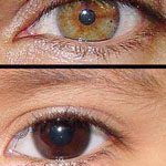 ���� ����� ������ ����� ������� ������� ���� ��� �� ���� ��������� ���� ��� ������ (Heterochromia)