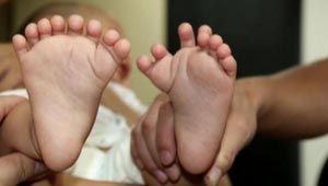 حالة نادرة.. ولادة طفل صيني بـ 31 اصبعا