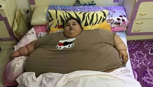  صور مؤلمة: مصرية وزنها 500 كغم  لم تخرج من بيتها منذ 25 عاما!