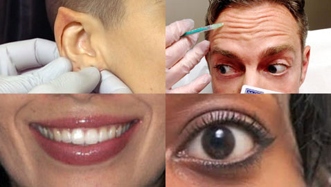 إليكم أغرب 10 عمليات تجميل في العالم