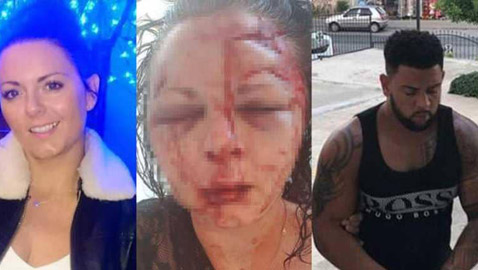 صور مروعة.. إعتداء وحشي على سائحة بريطانية في تركيا