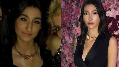تهديد ملكة جمال تركيا بسحب اللقب بسبب  صور (قبل وبعد)!