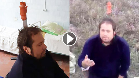 فيديو مروع.. رجل روسي غرس سكينا في رأسه لمساعدته على التنفس!