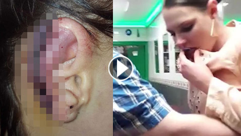 فيديو صادم.. امرأة امريكية انقضت على صديقتها وقضمت أذنها 