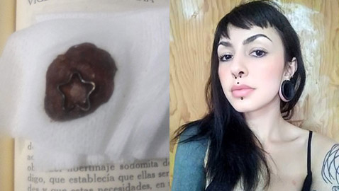 إستأصلت جزءا من جسدها لتقدمه هدية لصديقها كدليل على (الحب الأبدي)!