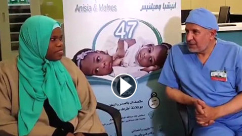 فيديو: والدة توأم سيامي تعلن اسلامها بعد نجاح طبيب سعودي بفصل توأمها