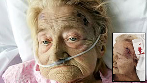 اعتداء وحشي على عجوز مريضة داخل مستشفي يؤدي لمصرعها.. والسبب!!