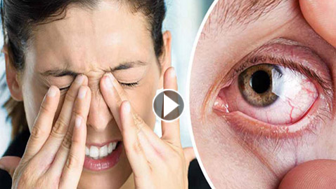 الحذر.. أعراض قد تعاني منها العين خلال النظر إلى كسوف الشمس