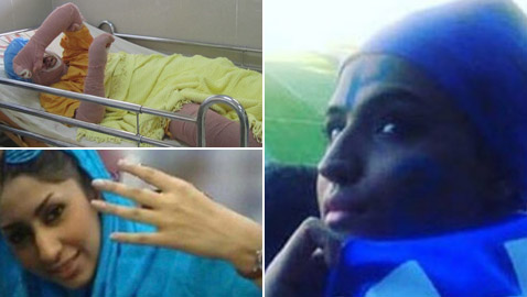 وفاة المشجعة (فتاة إيران الزرقاء) بعد أن أضرمت النار في نفسها!