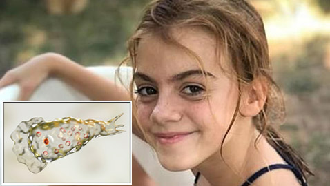 كائن مميت يتسلل إلى دماغ فتاة أثناء السباحة ويفتك بها في 7 أيام! صور