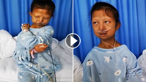 وزنها أصبح 21 كغم.. غضب في الصين لأجل شابة تدعم أخاها المريض!