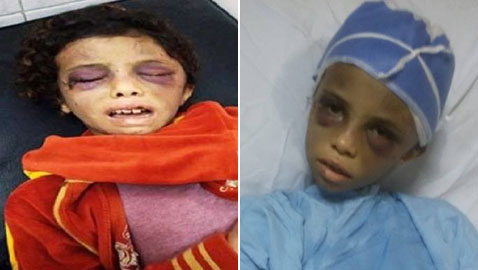 هذا ما فعلته خالة بابنة أختها في مصر