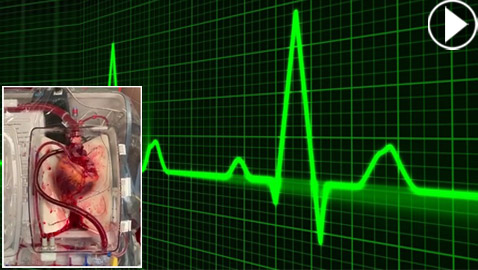 معجزة.. علماء يعيدون قلبا ميتا للحياة بسابقة تحدث لأول مرة في العالم!