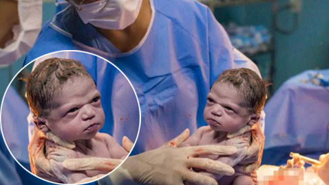 صور طريفة: طفلة تنظر بوجه غاضب إلى طبيبة التوليد في البرازيل