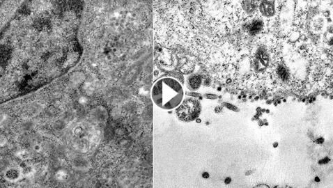 شاهد من مجهر إلكتروني أول رصد للفيروس وهو يمسك بالخلية