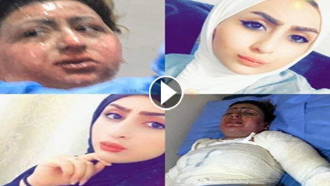 مأساة تحبس الأنفاس.. ابنة النجف حرقت نفسها وزوجها يشاهد