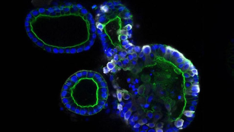 كشف أول صور تفصيلية تظهر شكل فيروس كورونا