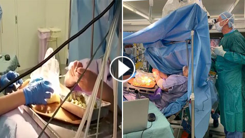 فيديو مثير: سيدة إيطالية تحضر وجبة شهيرة خلال عملية دماغ مفتوح خطيرة