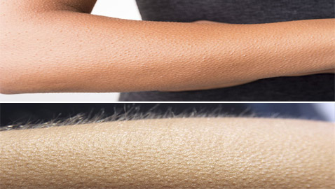 أخيرا توصّل العلم إلى تفسير للظاهرة: لماذا نصاب بالقشعريرة؟!