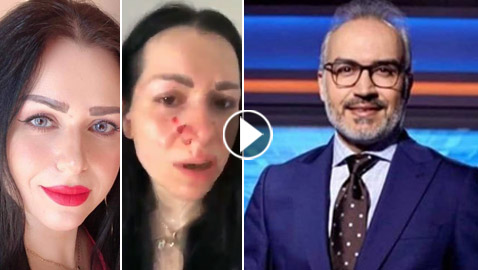 زوجة إعلامي سوري تشتكيه للشرطة بعد أن ضربها بقسوة رغم أنها حامل!