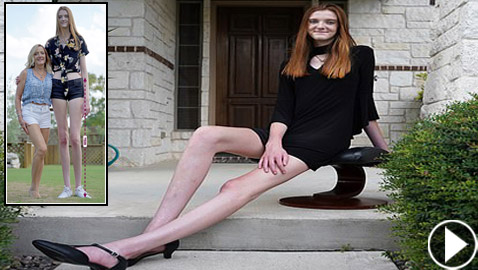 فيديو وصور: فتاة تمتلك أطول ساقين في العالم.. يزيد طولها على مترين!