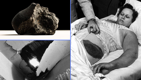 هدية من السماء أو لعنة.. ماذا حصل للشخص الوحيد الذي ضربه نيزك؟